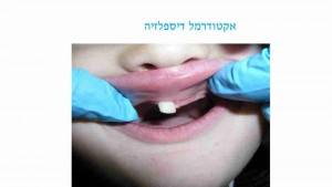 הפרעות במספר השיניים אצל ילדים - דר מלכה אשכנזי